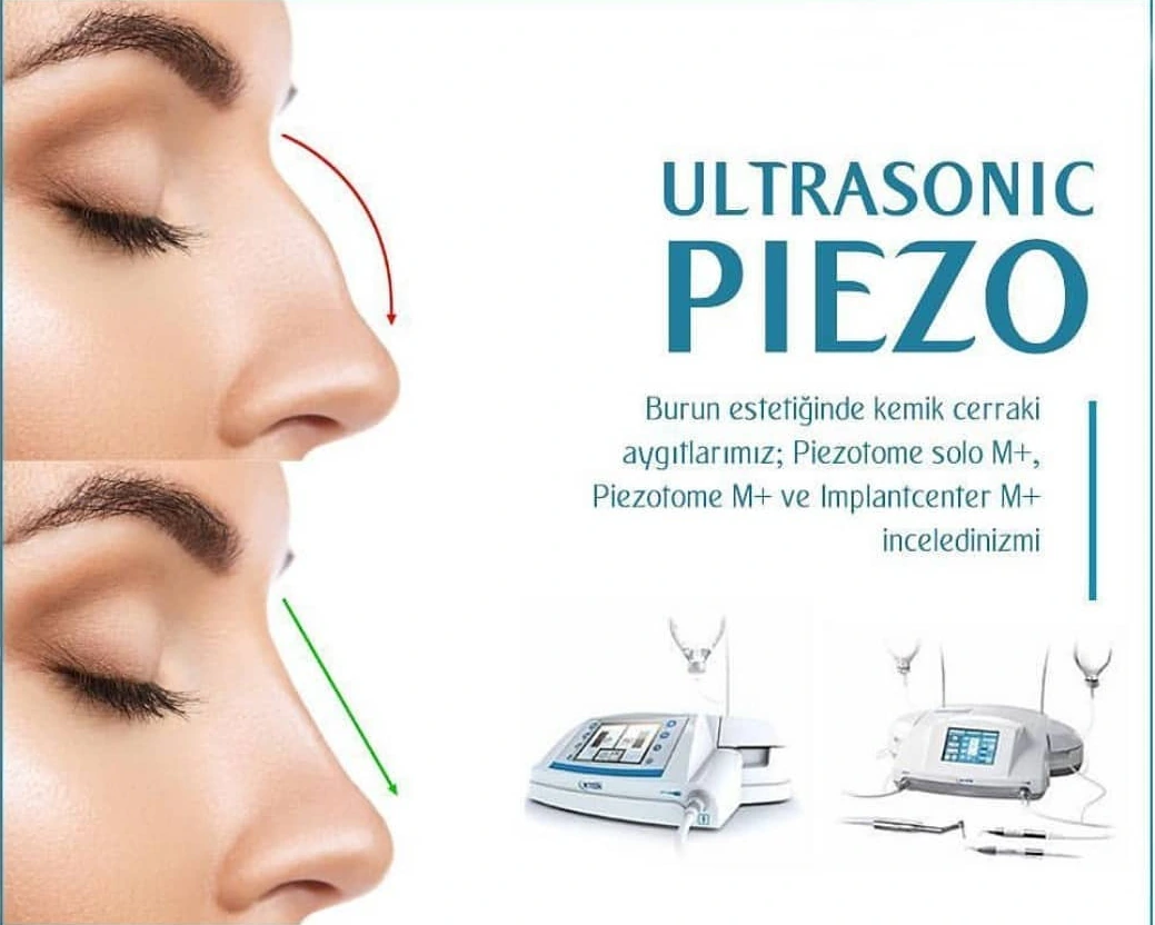 Ultraschall-Piezo-Chirurgiegerät